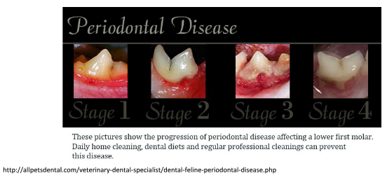 Stages of Dental Disease